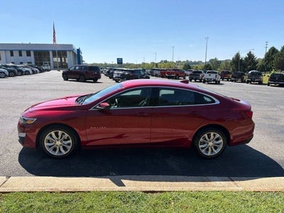2025 Chevrolet Malibu 1LT
